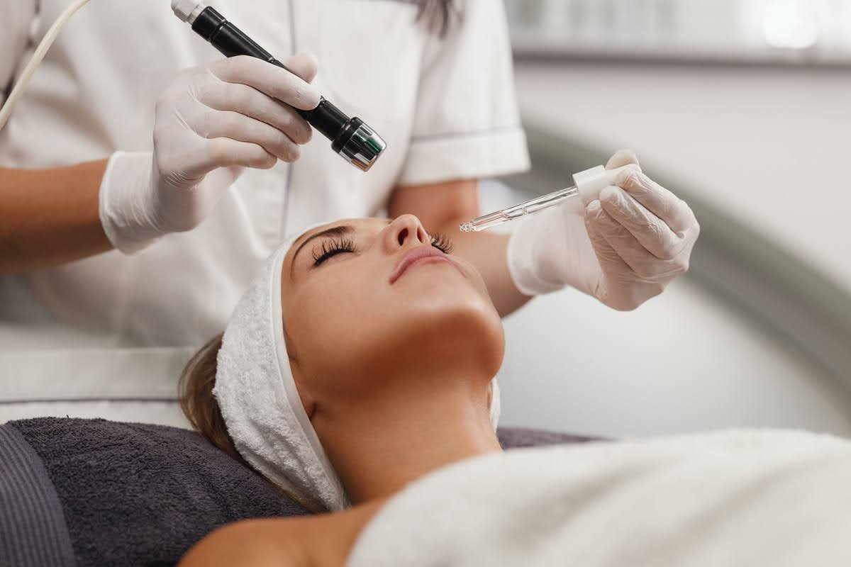 Microneedling in Seattle 2